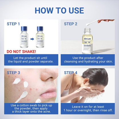 Drying Lotion for Pimple & Body Acne | Visibly Shrinks Pimples in 24 Hours & Helps Fade Acne Marks in 7 Days | 1.8% Salicylic Acid, 10% Sulfur & 4% Niacinamide | 20ml