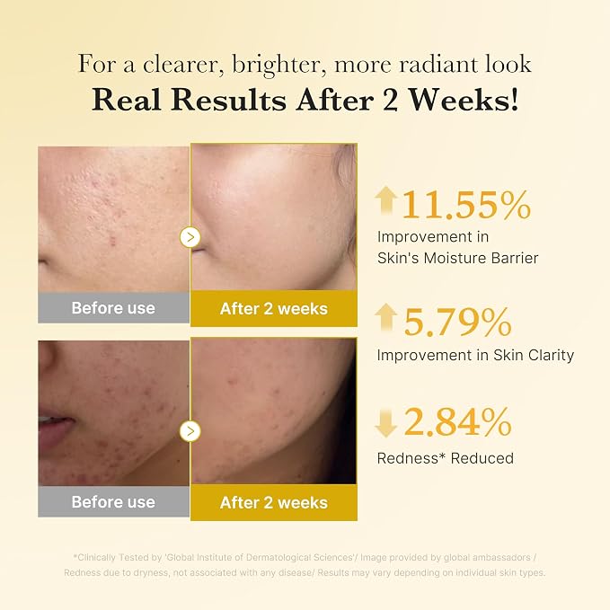 Kojic Acid & Turmeric Tone & Texture Care Set – 3-Step Daily Skincare Routine