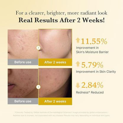 Kojic Acid & Turmeric Tone & Texture Care Set – 3-Step Daily Skincare Routine