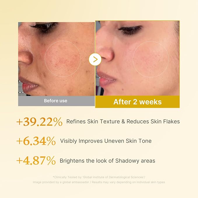 Kojic Acid & Turmeric Tone & Texture Care Set – 3-Step Daily Skincare Routine