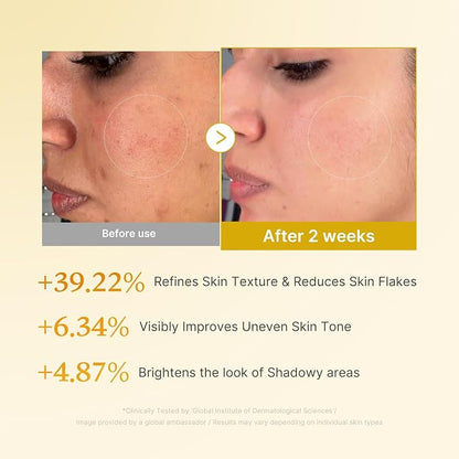 Kojic Acid & Turmeric Tone & Texture Care Set – 3-Step Daily Skincare Routine