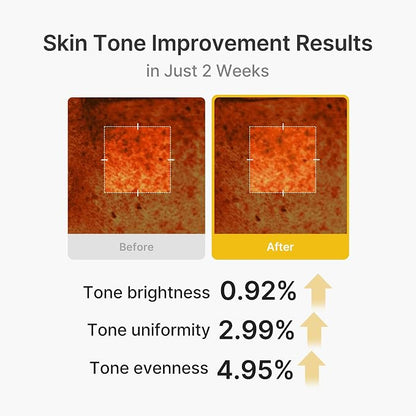 Kojic Acid & Turmeric Tone & Texture Care Set – 3-Step Daily Skincare Routine