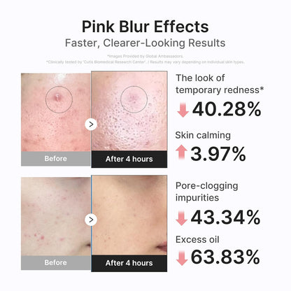 Overnight Pink Calamine Drying Lotion | Targeted Spot Care for Blemishes, Whiteheads, Blackheads & Oily-Prone Skin