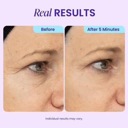 Instant Lift Under Eye Gel – Firming Eye Treatment for Puffiness, Fine Lines & Dark Circles