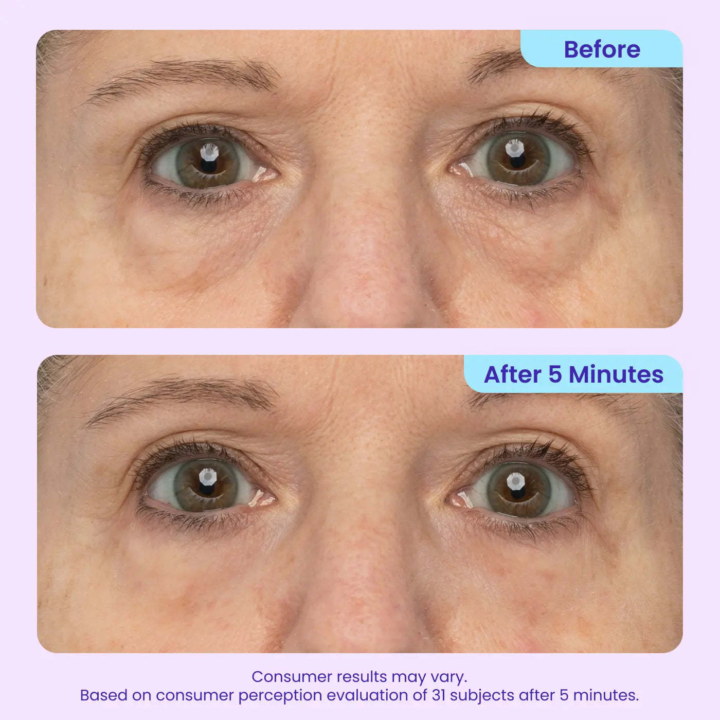 Instant Lift Under Eye Gel – Firming Eye Treatment for Puffiness, Fine Lines & Dark Circles