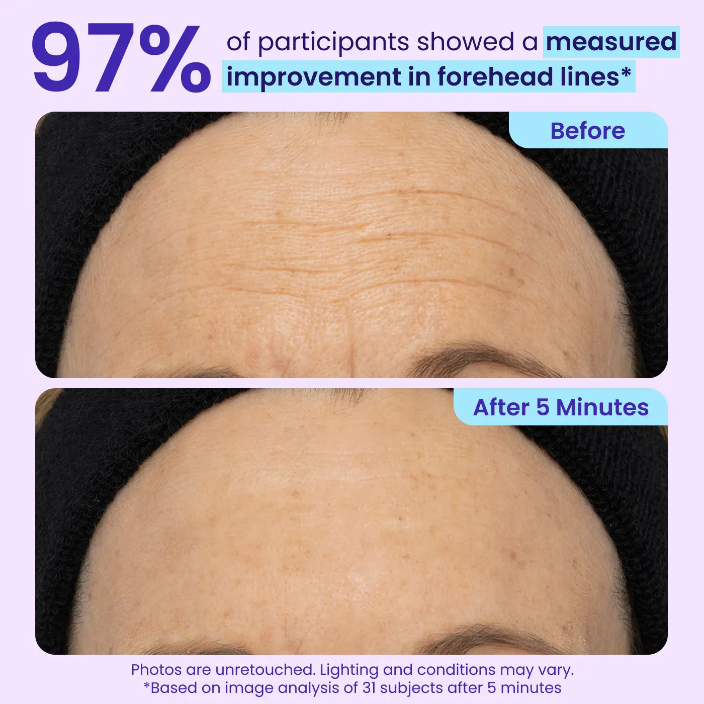 Instant Lift Under Eye Gel – Firming Eye Treatment for Puffiness, Fine Lines & Dark Circles