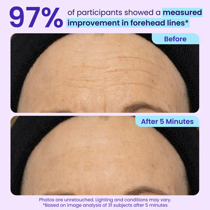 Instant Lift Under Eye Gel – Firming Eye Treatment for Puffiness, Fine Lines & Dark Circles
