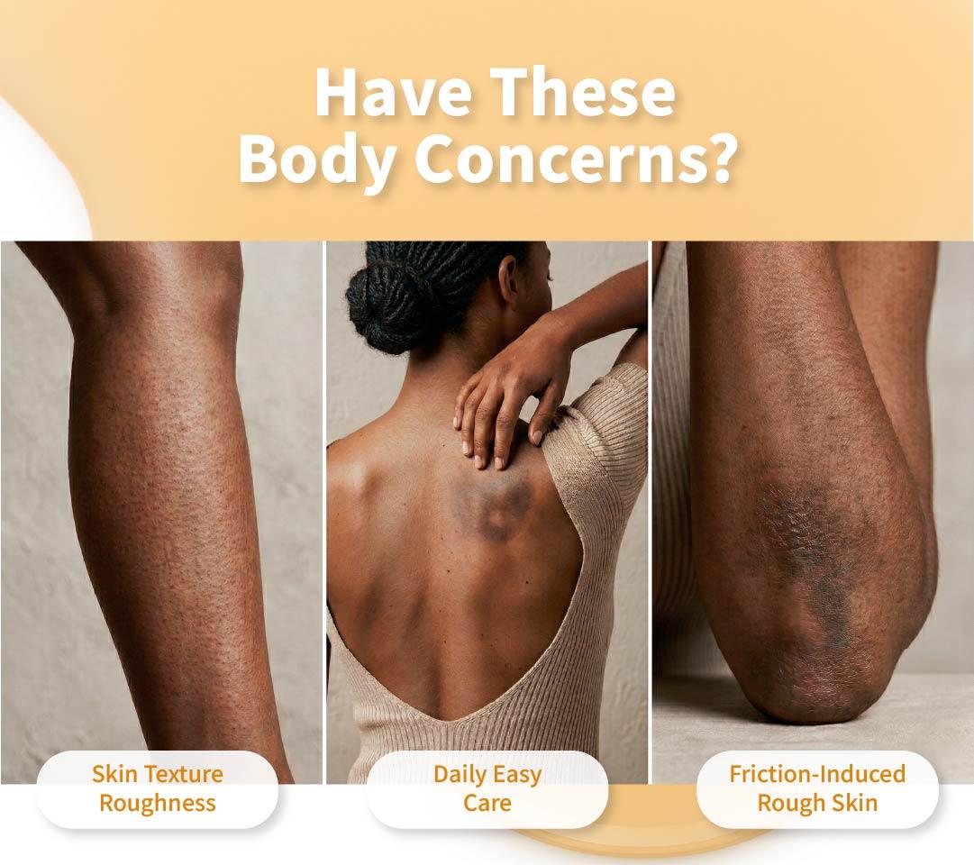 Kojic Acid Turmeric Body Brightening Spray | Exfoliating Treatment for Rough & Uneven Skin Tone