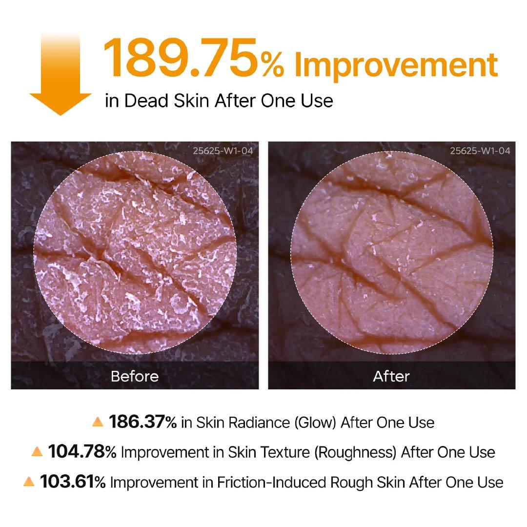 Kojic Acid Turmeric Body Brightening Spray | Exfoliating Treatment for Rough & Uneven Skin Tone