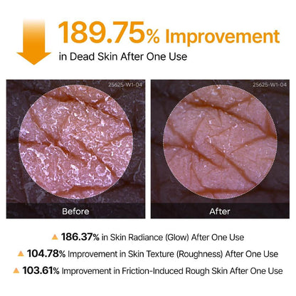 Kojic Acid Turmeric Body Brightening Spray | Exfoliating Treatment for Rough & Uneven Skin Tone