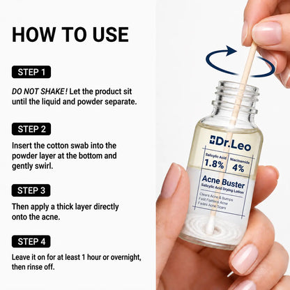 Drying Lotion for Pimple & Body Acne | Visibly Shrinks Pimples in 24 Hours & Helps Fade Acne Marks in 7 Days | 1.8% Salicylic Acid, 10% Sulfur & 4% Niacinamide | 20ml