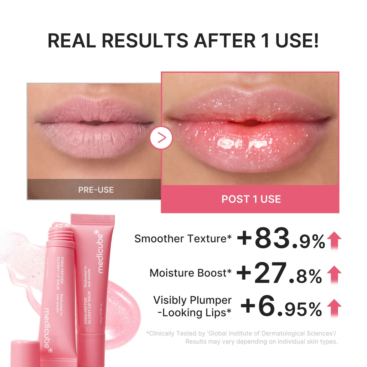 [NEW][medicube]PDRN Peptide Glossy Lip Balm – Hydrating Plumping Lip Gloss with Hyaluronic Acid & Shea Butter, Sheer Pink Pearl Shine